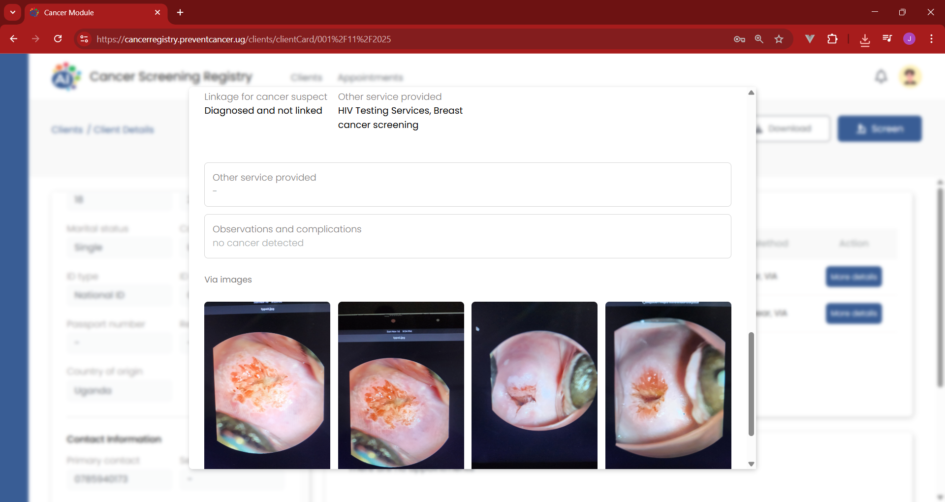 An Open-source Private Health Information Exchange system for cancer screening in low resource settings image 3