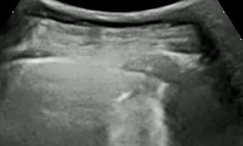 Ultrasound scan image